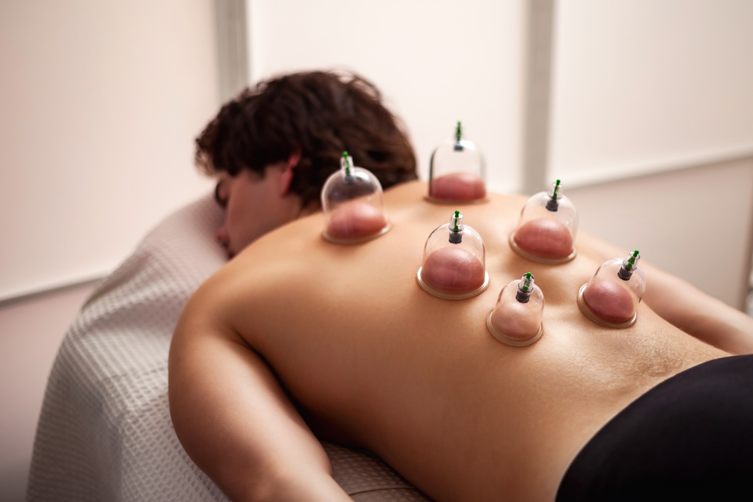 Why Frequent Headaches and Fatigue Could Be Your Body Asking for Hijama –Dr Mehwish Iqbal | Natural Detox Therapy in Sharjah